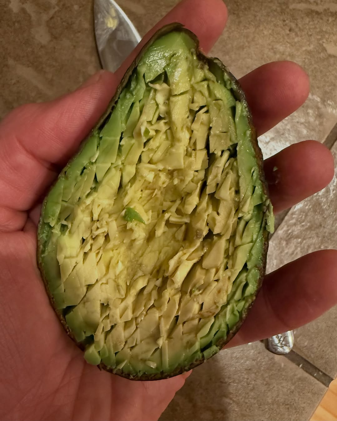 I have a friend whose a hand surgeon - I asked him if he’s ever had a patient who has cut their hand when prepping avocado. He said yeah it’s so common it’s actually called “avocado hand”. Be safe take your time.